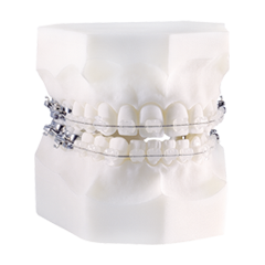 Fragen zur Kieferorthopädie